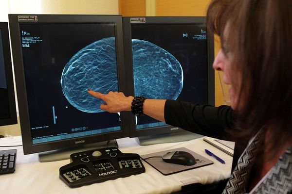 همه آنچه باید درباره ماموگرافی بدانید | این راهنما شما را با مهم‌ترین ابزار پیشگیری از سرطان سینه آشنا می‌کند  
